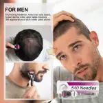 540 Needles Derma Roller | Facial & Body Hair Growth Tool