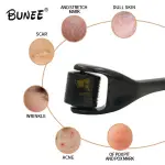 540 Needles Derma Roller | Facial & Body Hair Growth Tool